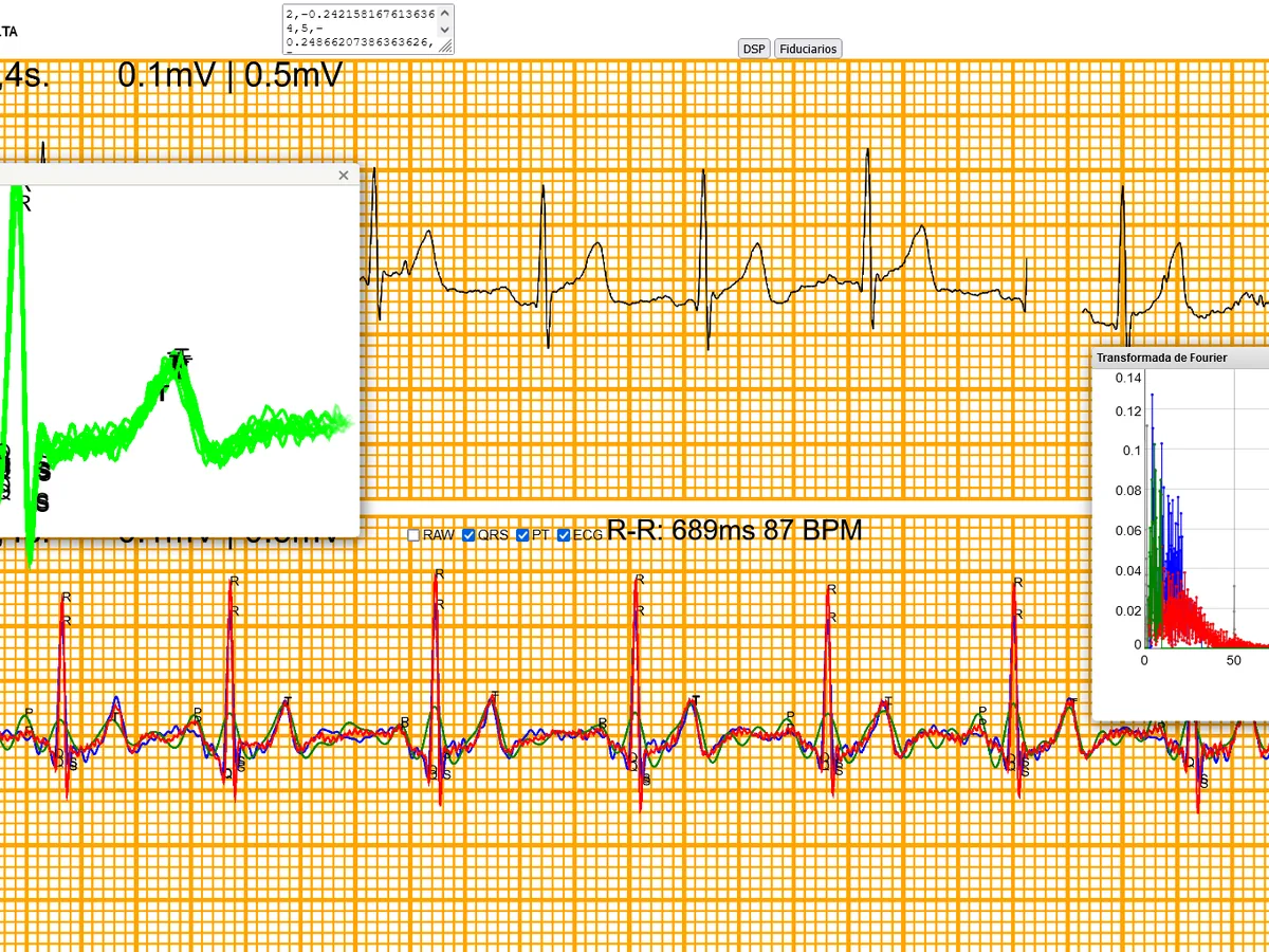 ECG dashboard with the signal, the zoomed QRS complex and the FFT spectrum